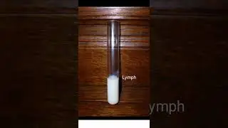 Lymph #lymphatic #lymphaticsystem #lymphatichealth #bodyfluidsandcirculation #science #shorts #fun