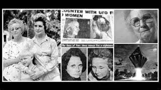 The Cash-Landrum Incident & UFO Injuries, Part 2