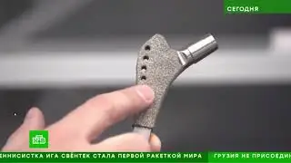 Как в Москве изготавливают эндопротезы из российского титана