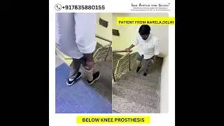 Best Below Knee Prosthetic | Artificial Leg For Running| Nakli Tang For Running| #naklipair #ossur