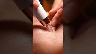 Gentle Forehead Pore Cleaning | Realistic ASMR 127