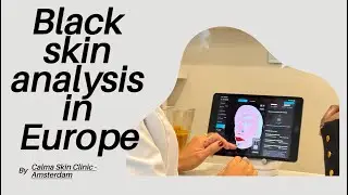 Black Skin Analysis in Europe| Calma Skin clinic