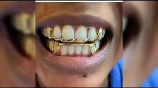 gold tooth gems, tooth dental jewellery, teeth art ideas, teeth jewellery design part 8