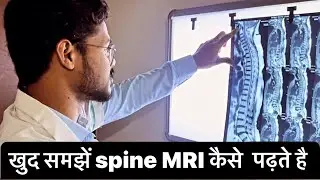 ख़ुद समझें Spine MRI कैसे पढ़ते है :mri spine slip disc ￼
