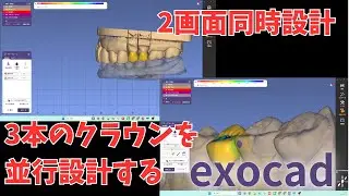 #263　2画面同時設計　3本のクラウンを並行で設計する（解説なし版）