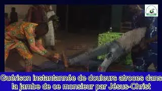Miracle de gu&eacute;rison instantann&eacute;e par J&eacute;sus Christ au travers du pasteur Sem Alain Sewanou