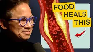 Dr. William Li: Reduce dementia risk with diet and lifestyle changes