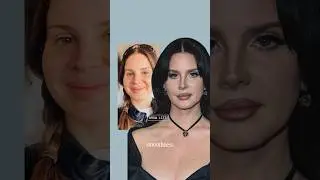 What Happened To Lana Del Ray&rsquo;s Face?