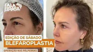 Blefaroplastia: cirurgia das pálpebras cresce em popularidade por estética e saúde