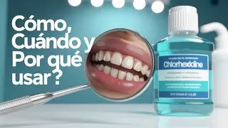 Clorhexidina: Secretos que tu Dentista Debería Contarte!