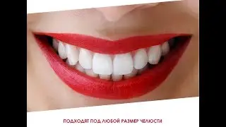 Snap On Smile Реальные