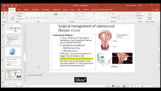 Fibroids Treatment Options Last Part