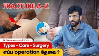 Fracture Treatment (எல்லம்பு பரிக்கள் ) | Cast, Surgery & Bone Healing Stages | Dr. Saravanakumar