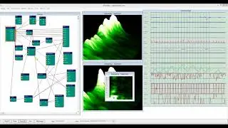Biofeedback/neurofeedback with ZMax and Brainbay
