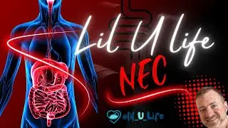 What is Necrotizing Enterocolitis?