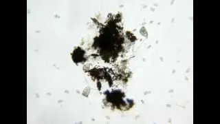 Ciliata