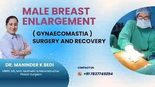 Male breast enlargement ( gynaecomastia ) surgery and&nbsp;recovery | SPAW Hospital Mohali, Chandigarh