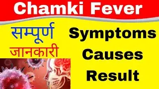 CHAMKI FEVER | CAUSES & SYMPTOMS | BIHAR