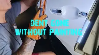 dent repair on body line Honda civic type R
