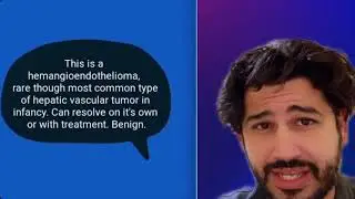 2 Liver Tumors case review