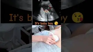 Ultrasound showing boy baby !!!🤰