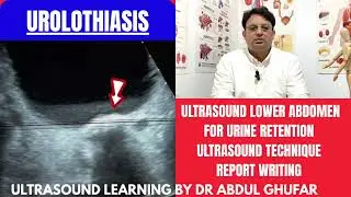 Bladder stones | Urinary bladder ultrasound | KUB ultrasound | urinary tract infection | bladder usg