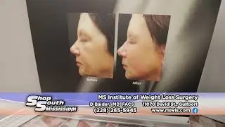 SSM - MS INSTITUTE OF WEIGHT LOSS SURGERY 5-22-23