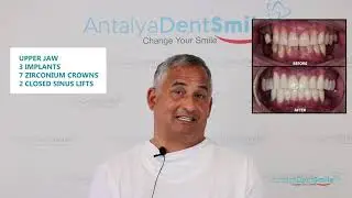Nuray Attila - Patient Review