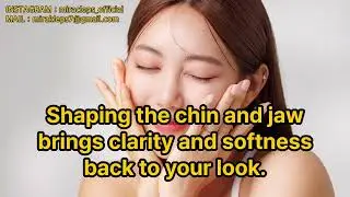 [Thread Lift] Lines, Jaw Cheeks&mdash;done #lifting