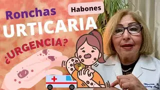 URTICARIA, RONCHAS o HABONES. ¿Realmente una URGENCIA?