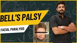 Bell&rsquo;s Palsy Explained | Facial Paralysis Causes, Symptoms & Physiotherapy Treatment