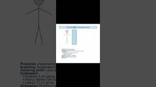 positioning of chest xray.#chestxray #radiologyshorts