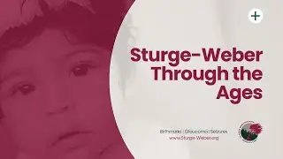 Sturge-Weber Through the Ages