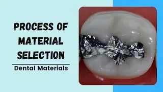 Process of Dental Material Selection | Dental Materials