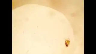 Bursaria truncatella under stereomircoscope