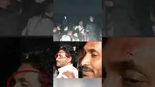 Ys jagan attacked by a stone #ysrcp #ysjaganspeech #apelections2024 #jagananna #siddhamsabha