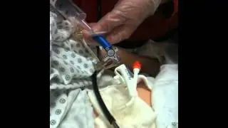 Administration of Medications Through a G-Tube