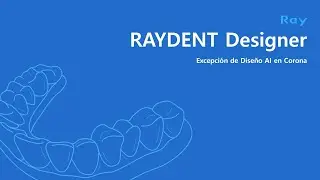 RAYDENT Designer: Excepci&oacute;n de Dise&ntilde;o AI en Corona