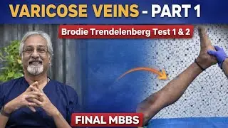 Varicose Veins: Trendelenburg Test I & II &ndash; Step-by-Step Clinical Approach | MBBS Finals