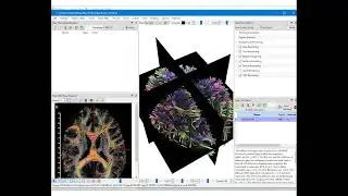 Differential Tractography for Cross Sectional and Longitudinal Studies