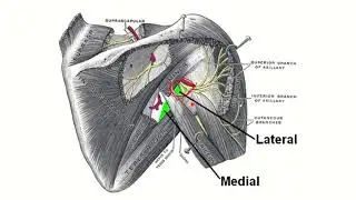 Quadriangular space near humerus MRCS question solve (CRACK MRCS)