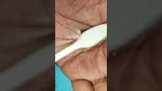 POCO X3 Pro sound problem solution//#mcarebalasore #ytshorts #short #viral #viral #mobilerepairing
