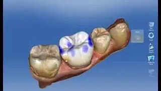 CeraSmart