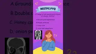 💡NEET PG Rapid revision | PYQs | High yield PYQs#exammotivation #facts #neetpgtricks #neetpgexam