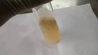 Penicillium growth on SDA