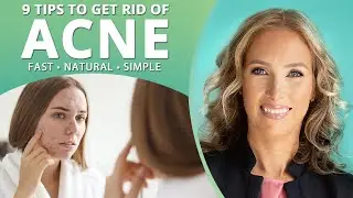 ACNE | 9 Tips to Get Rid of Acne | Dr. J9 Live