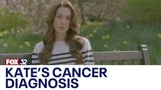 Kate Middleton's diagnosis: Chicago oncologist weighs in on her condition
