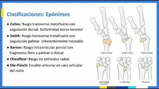 Fractura de Radio Distal - Seminario Ortopedia y Traumatolog&iacute;a PUC 2024