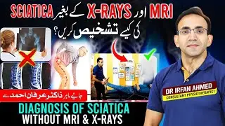 Learn How Diagnosis of Sciatica  made Simple without MRI and X.rays | Urdu |Hindi