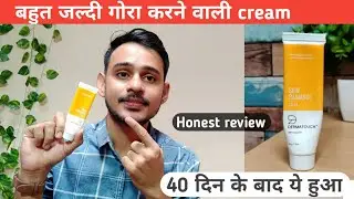 क्या होगा अगर हम dermatouch skin rediance cream को 40 दिन तक use करे  || bye bye pigmentation cream